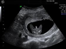 Gender Scans