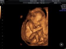 17week 3D