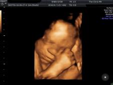 3D 30weeks