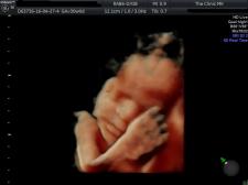 HD Live 30weeks