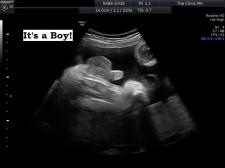 Boy