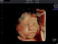 30week HD Live